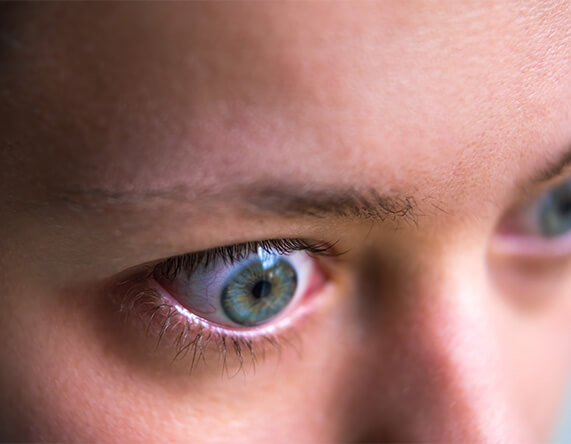 What Is Thyroid Eye Disease?